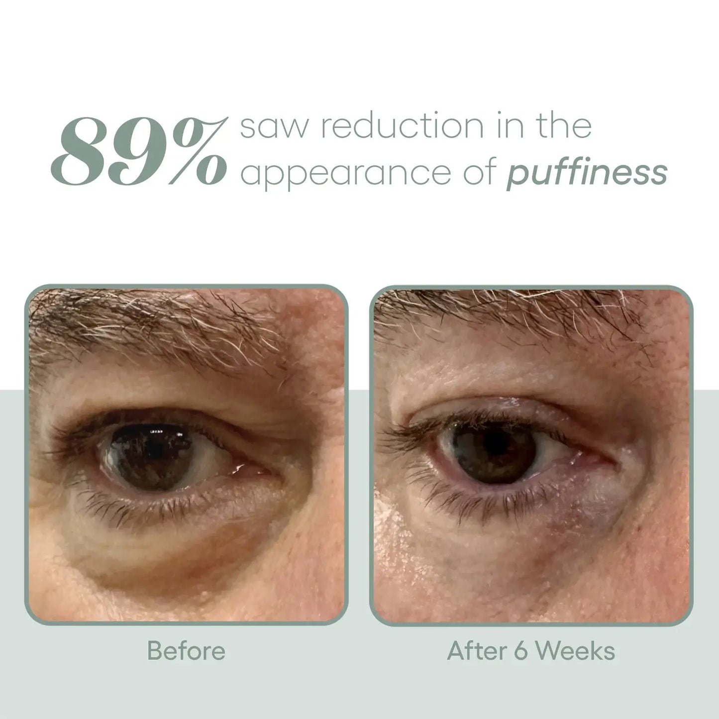 Plated™ Eye Serum
